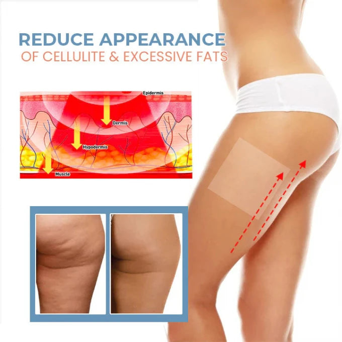 Patchs de collagène anti-cellulite.